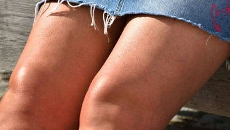Pelle secca e screpolata, come prendersi cura di gomiti e ginocchia