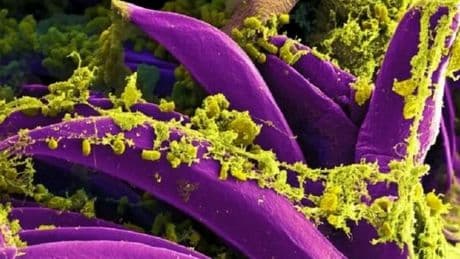 Peste polmonare, morto un uomo in Arizona: i sintomi e il contagio, l'ultima vittima negli Usa nel 1924 a Los Angeles