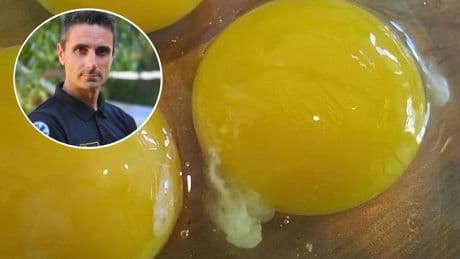 Miguel Assal, experto en primeros auxilios, avisa sobre lo que esconden los huevos con hilitos blancos: "Es chalaza"