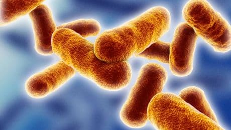 One dead and three seriously ill in anthrax outbreak as WHO alerted