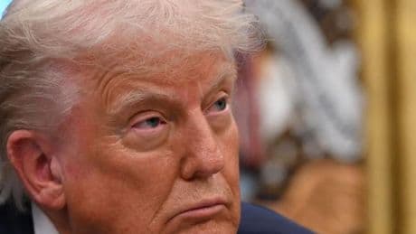 Donald Trump souffre d’une « insuffisance veineuse », une « affection bénigne et courante » chez les plus de 70 ans, assure la Maison Blanche
