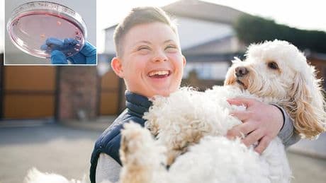 Breakthrough new treatment could REVERSE Down syndrome
