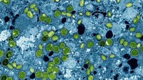 Mpox-Sorge: Forscher fordern Maßnahmen zur Eindämmung des Pocken-Virus