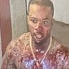 Shocking pictures show Tory Lanez covered in blood after being stabbed 14 times inside California prison where he is serving ten years for shooting Megan Thee Stallion