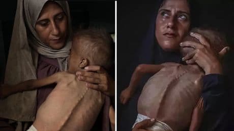 NY Times'in haberi İsrail'in algısını yerle bir etti: Abluka destekli ölüm!