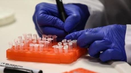 M çiçeği virüsü kaynaklı ilk ölüm gerçekleşti