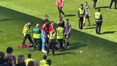 Skandal in Schottland: Gesichtsverletzung: Fußballprofi von Sitzschale getroffen