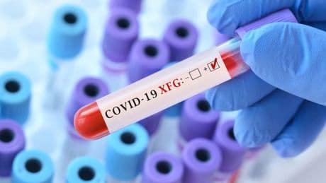 Covid cases climb to highest level this year with thousands testing positive