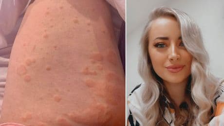 ‘I’m no anti-vaxxer, but I regret getting the Covid jab’