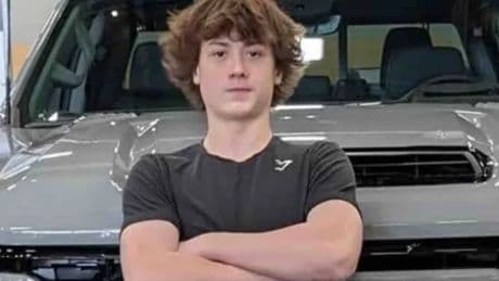 ‘He felt something crawl on him:’ Simple spider bite leaves teen with failing kidneys and unable to speak