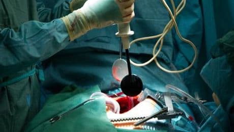 Krankenkassen drängen wegen Finanzmisere auf Kosten-Notbremse