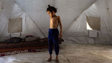 How to Prevent More Starvation Deaths in Gaza