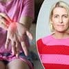 Lisa thought her itch was just an allergy. In fact it was a common liver problem that mostly strikes women, often goes undetected for years and causes catastrophic damage. Now doctors reveal the signs