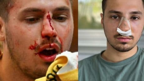 Prügel-Skandal im Handball - Ex-Bundesliga-Star über 2 Jahre gesperrt