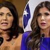 Plastic surgeons reveal what could be behind ICE Barbie Kristi Noem's changing face