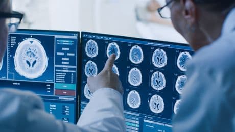 ‘Revolutionary’ AI-assisted tool could help stroke patients make full recovery