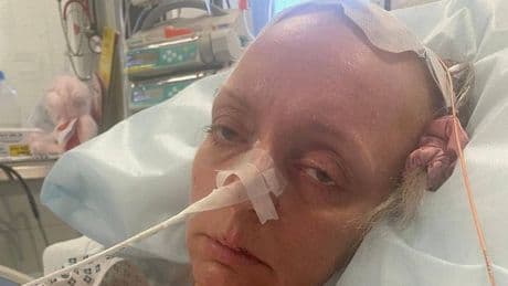 'I went to bed with a headache - and didn't wake up for six weeks'