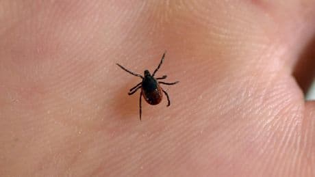 What is Lyme disease? And how to avoid tick bites