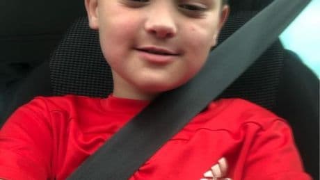 Boy, 8, mauled in the FACE by vicious ‘Staffy’ who pounced on him in street leaving horror injuries