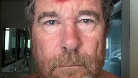 British photographer films moment US police shoot him with rubber bullet
