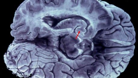 Estudian el cerebro humano y descubren que todos tenemos un 'sexto sentido' que podemos despertar