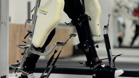 Robot destekli tedavi çok ağır felçli hastalarda bile yürüme şansını yüzde 48 artırıyor