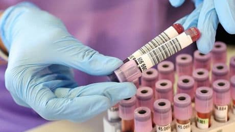 Oggi la giornata dei tumori del sangue: ogni anno 30mila nuovi casi in Italia, ecco le ultime terapie
