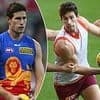Footy star has to be hospitalised after being bitten by a DOG mid-match