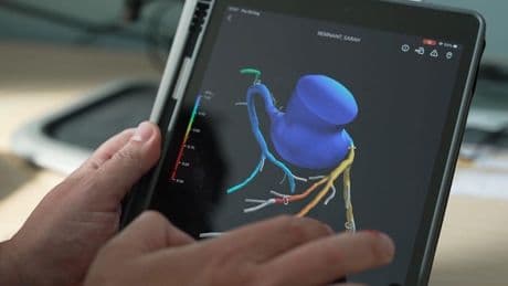 3D heart scans have saved NHS millions since 2021 rollout, data shows