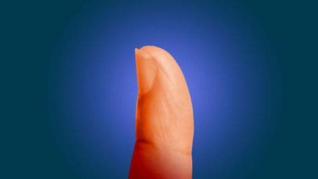 A European company is pioneering diabetes monitoring without the needle