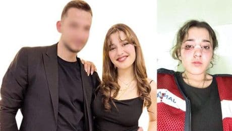 Nişanlı dehşeti... Yüzüne kafa attı kaskıyla darp etti