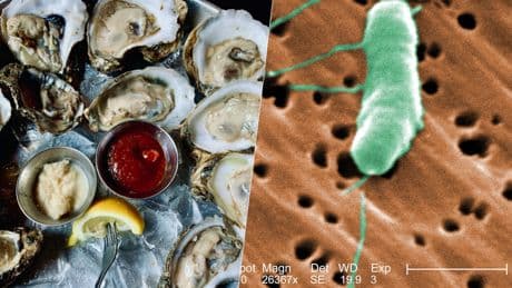 Qué es la "bacteria carnívora” y por qué Europa cree que ahora es el mejor momento para extremar precauciones