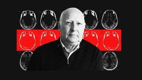 Arturo Goicoechea, neurólogo: "El dolor siempre es real pero lleva a error, el hombro también duele por causas emocionales"