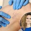 I hate the ugly veins in my legs... is there a way to get rid of them? DR ELLIE reveals the treatments available - and the simple seating position that can help