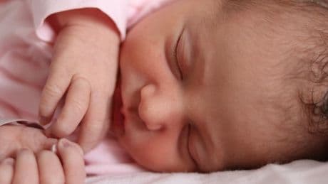 Roma: neonata salvata da un raro tumore di 800 grammi. Un doppio intervento ha rimosso la neoplasia