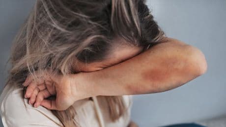 Häusliche Gewalt erreicht in Deutschland Allzeithoch