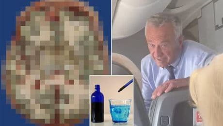 Mysterious blue brain found in autopsy linked to RFK Jr's 'miracle cure'