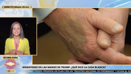 La razón de la Casa Blanca para justificar el maquillaje en las manos de Trump: "No convence a todo el mundo"