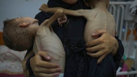 Hundreds of sick children from Gaza to be evacuated to UK for critical NHS treatment