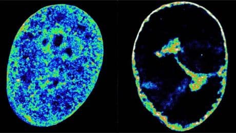 Golpe español al herpes labial: descubren cómo remodela el genoma humano para expandirse