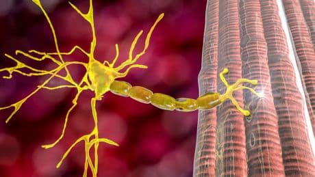 Myopathie de Duchenne: une thérapie génique suscite un espoir immense