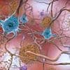Common mid-life problem linked to dementia risk - 'It's a warning sign', say experts