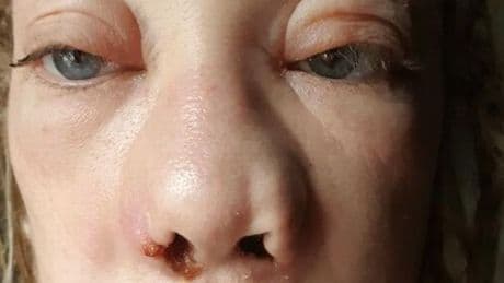 Mum in 'pain worse than childbirth' after botched Turkey teeth surgery