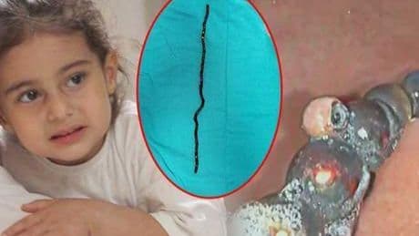 7 ay karnında taşıdı! 3 yaşındaki Berfin doktorları şoke etti! 'Bu oyuncak değil, ölüm tuzağıymış'