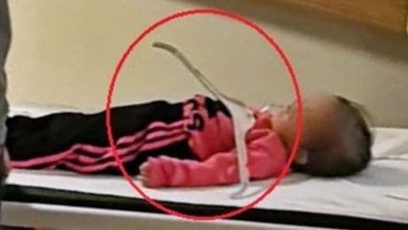 Oynadığı elbise askısı çenesine ok gibi saplandı! Annesinin başından aşağı kaynar sular döküldü