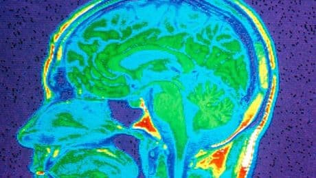 One common health issue could accelerate cognitive decline, research warns
