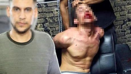 Dişleri kırılıp, hamam böceği yedirildi! 3 günlük işkencede şok rapor