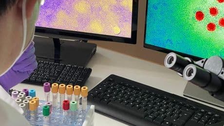 Une mystérieuse épidémie d’hépatite A frappe Lyon, après Nantes
