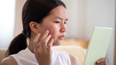 Ask an expert: Is cortisol giving me a puffy face and belly fat?