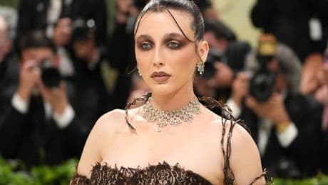 Inside Emma Chamberlain’s ‘life changing’ diagnosis after stranger spotted symptom at hair salon